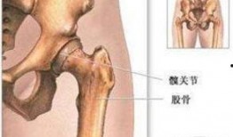 髋关节吃六瓜,髋关节健康之道